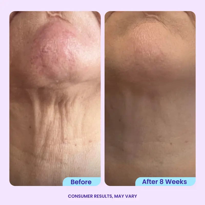 Tighten & Smooth Belly Cream, MicroTight4 Complex Body Firming Lotion for Loose Skin