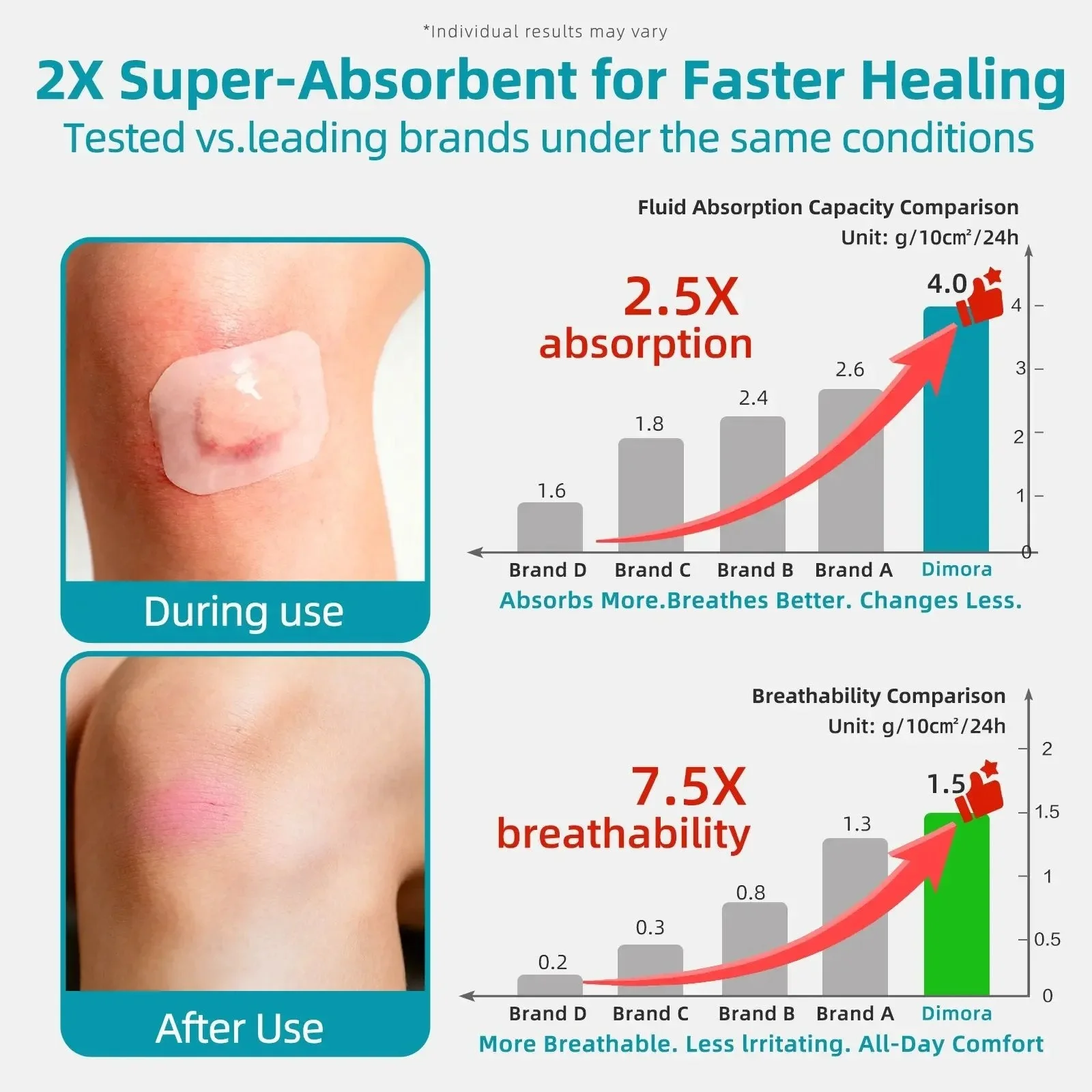🏆75K+ SOLD!✨ Medical-Grade Hydrocolloid Acne Patch Roll